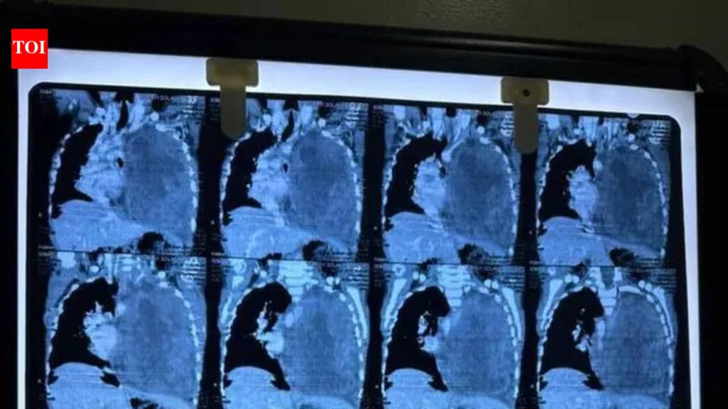 3-year-old on road to recovery after rare lung tumour surgery | Vadodara News