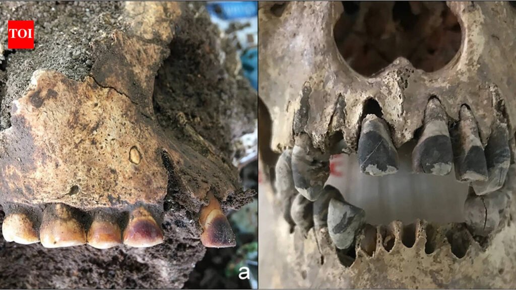 2,000 years ago, people in Vietnam used iron to permanently blacken their teeth | World News