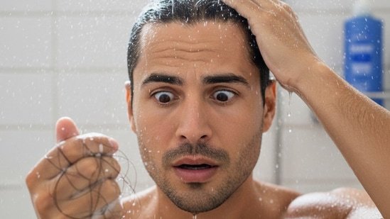 Does hard water cause balding? Dermatologist explains how it affects hair health and why it needs medical attention