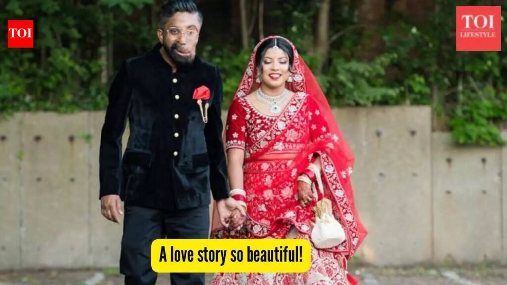 He hid his face for years-until one woman helped him show it to the world: How self-acceptance changed a man’s life