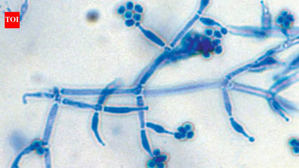 How to use Trichoderma to protect home plants from root diseases and promote better growth |