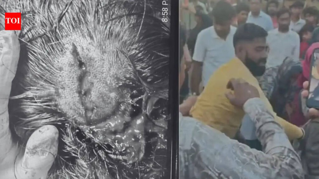 Attempt to save injured dog turns violent in Faridabad; rescuer critical, undergoes emergency surgery | Gurgaon News