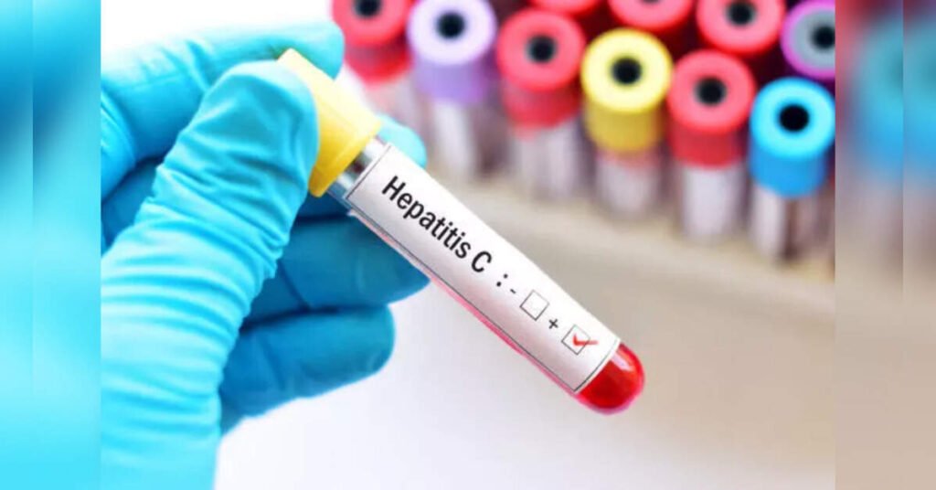 39 including 14 students taken ill as jaundice spreads in Himachal’s Hamirpur, ETHealthworld