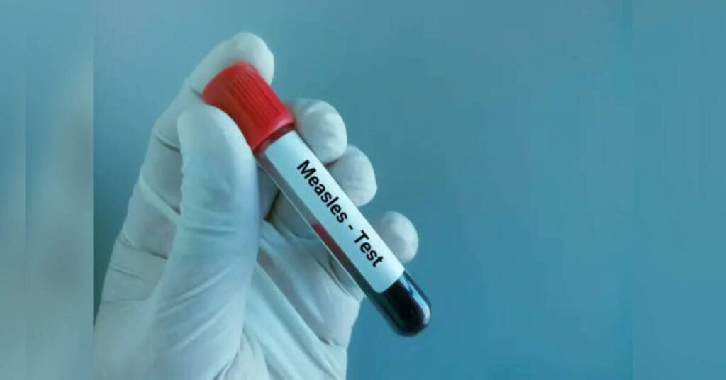 Bangladesh PM Orders Immediate Action to Address Measles Outbreak Amid Rising Cases, ETHealthworld