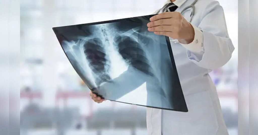 Fake X-rays created by AI fool radiologists and even AI itself, ETHealthworld