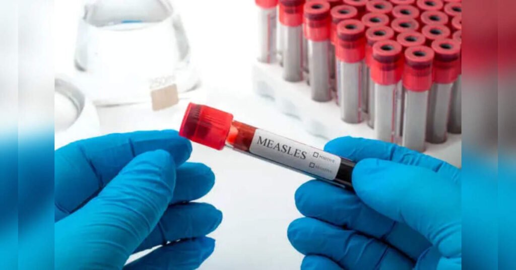 Bangladesh’s Measles Outbreak Claims Nearly 100 Lives; Urgent Vaccination Efforts Underway, ETHealthworld