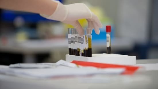 Do routine blood tests tell the full story? Radiologist shares women’s health issues that only imaging tools can detect