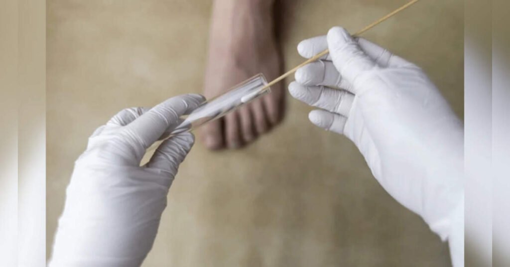 Odisha lacks in fungal disease diagnosis: Study, ETHealthworld