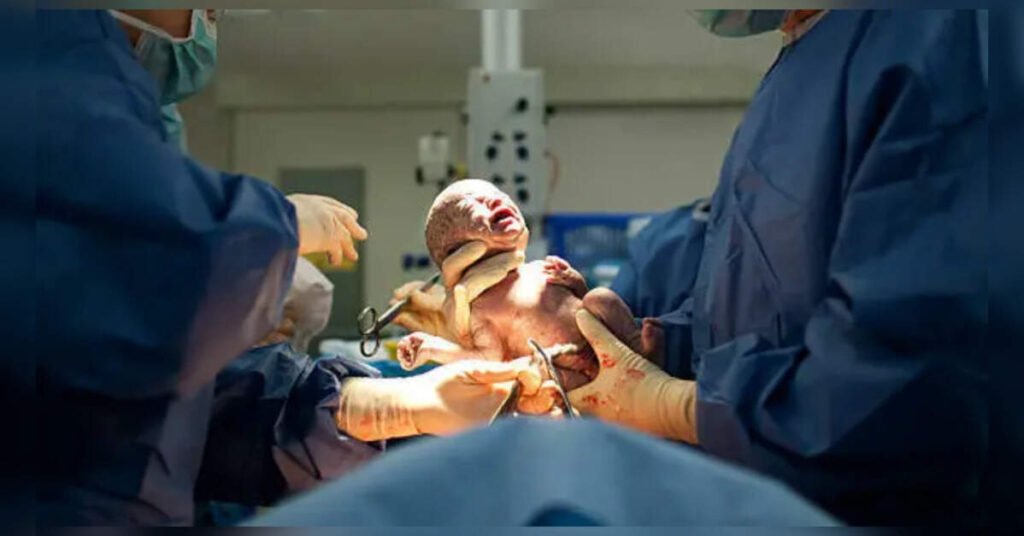 Private C-sections in Maharashtra skyrocket to 56%, five times WHO norms, ETHealthworld