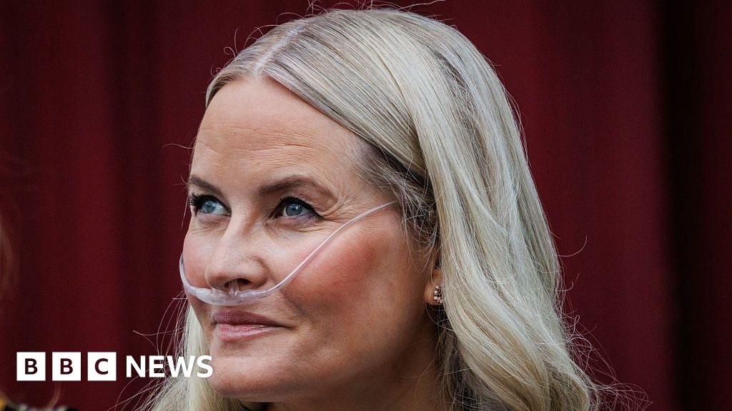 Norway’s crown princess undergoes successful lung transplant, palace says