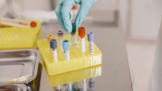 AIIMS-trained gastroenterologist shares 4 underutilised tests: ‘They can completely change a diagnosis’