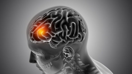 Personality suddenly changed? Neurologist Dr Mudasir Mushtaq Shah reveals when it may mean a brain tumour