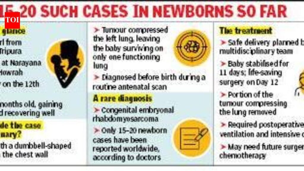 3-month-old back home after surgery to remove cancerous tumour | Kolkata News