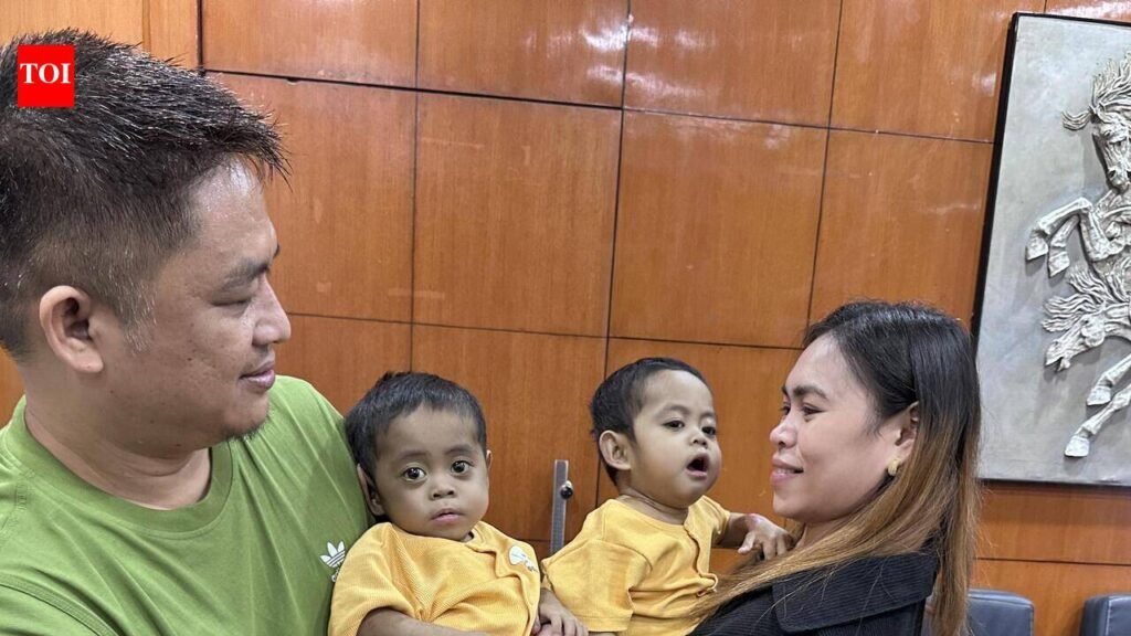 ‘They fought and overcame together’: How a Delhi hospital gave Filipino twins a second chance at life | Delhi News