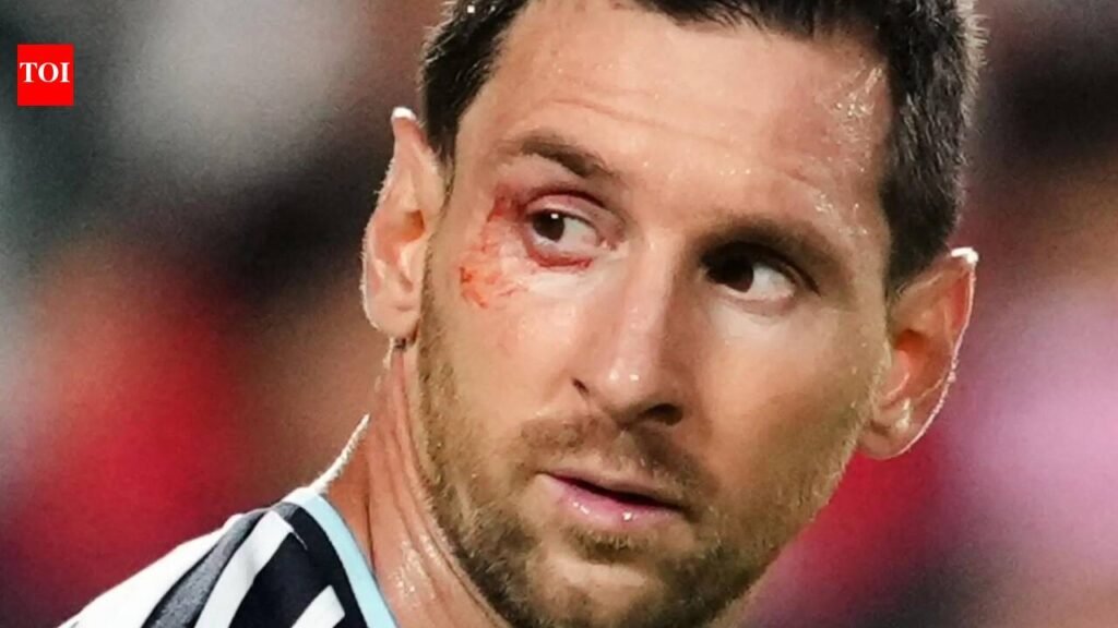 No easy wins in FIFA World Cup: Lionel Scaloni says ‘suffering part of our DNA’ as Argentina survive Switzerland scare | Football News