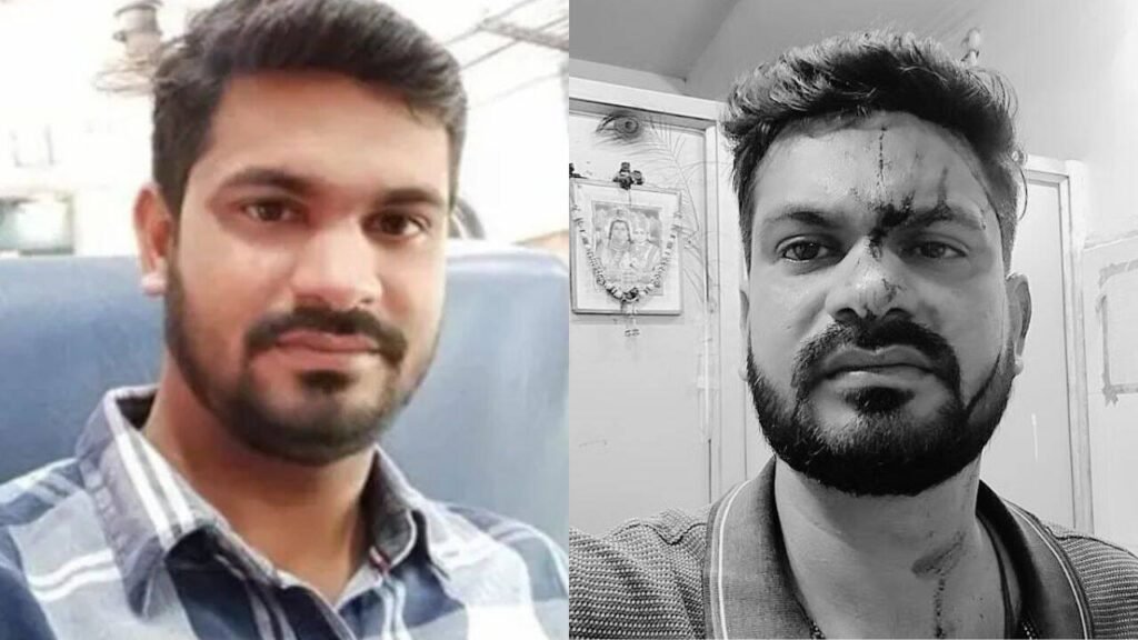 Odisha man dies after wife ‘hits him with mobile phone’; post-mortem points to liver failure | Bhubaneswar News