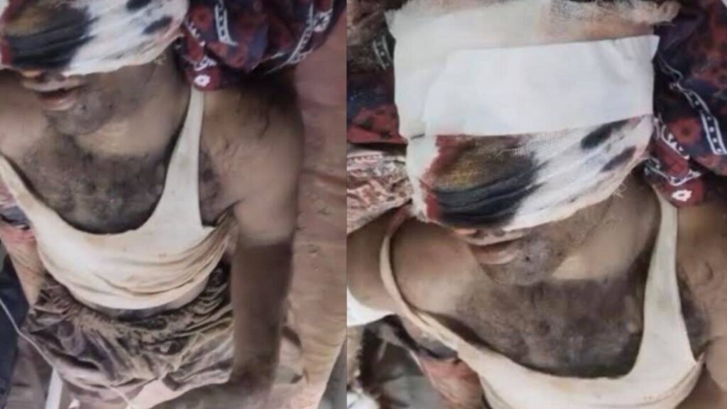 ‘Improper intentions toward my wife’: Rajasthan man’s nose, ear severed over family dispute; 2 detained | Jaipur News