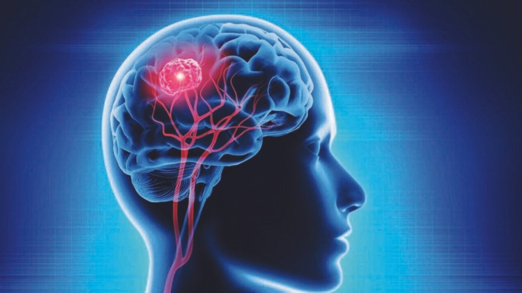 Hyd institute launches study on rare brain disorder | Hyderabad News