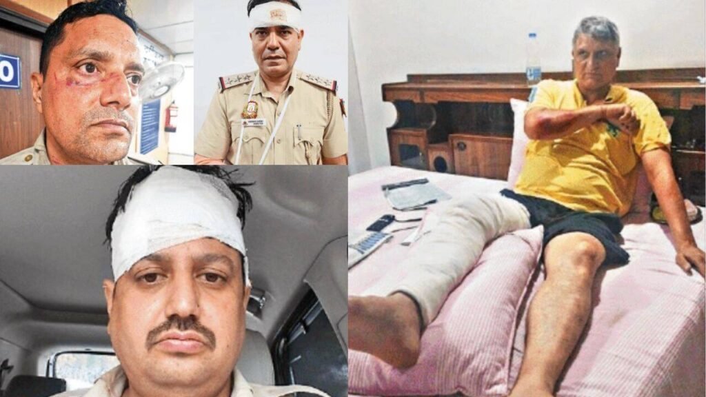 Crowd suddenly turned violent, say injured cops | Delhi News