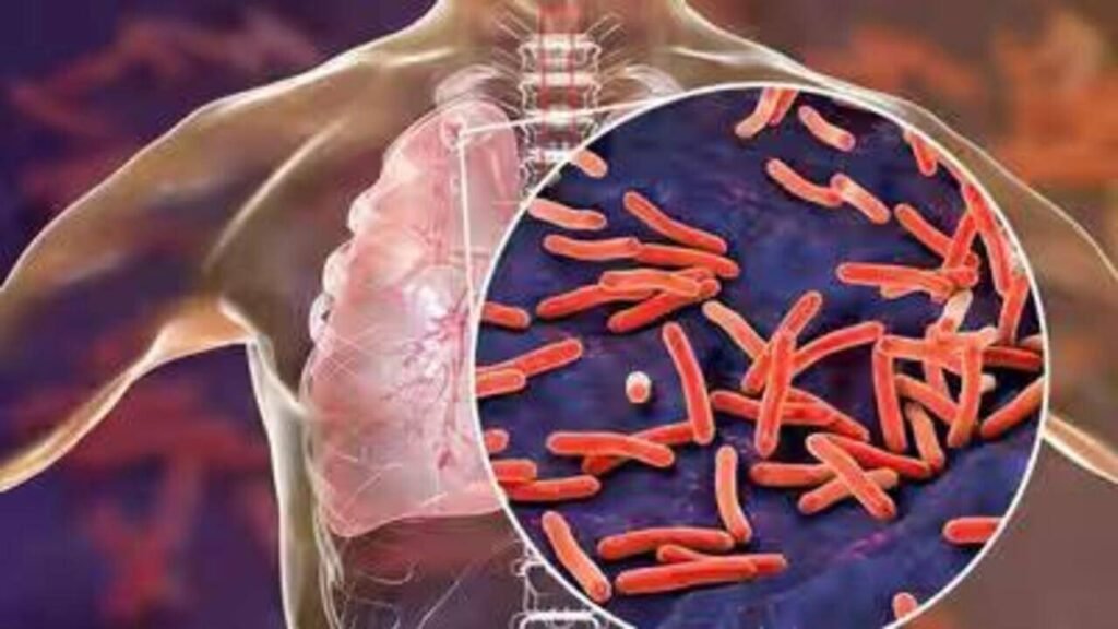Over 8k TB cases detected in statewide screening drive | Patna News