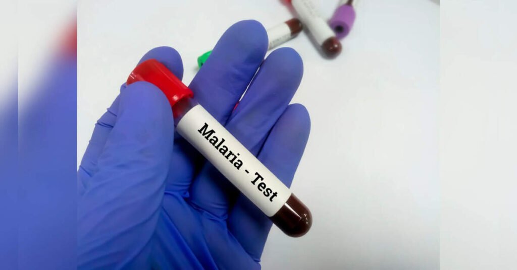 243 malaria cases detected in East Singhbhum as outbreak spreads to Ghatsila, Dumaria and Musaboni, ETHealthworld