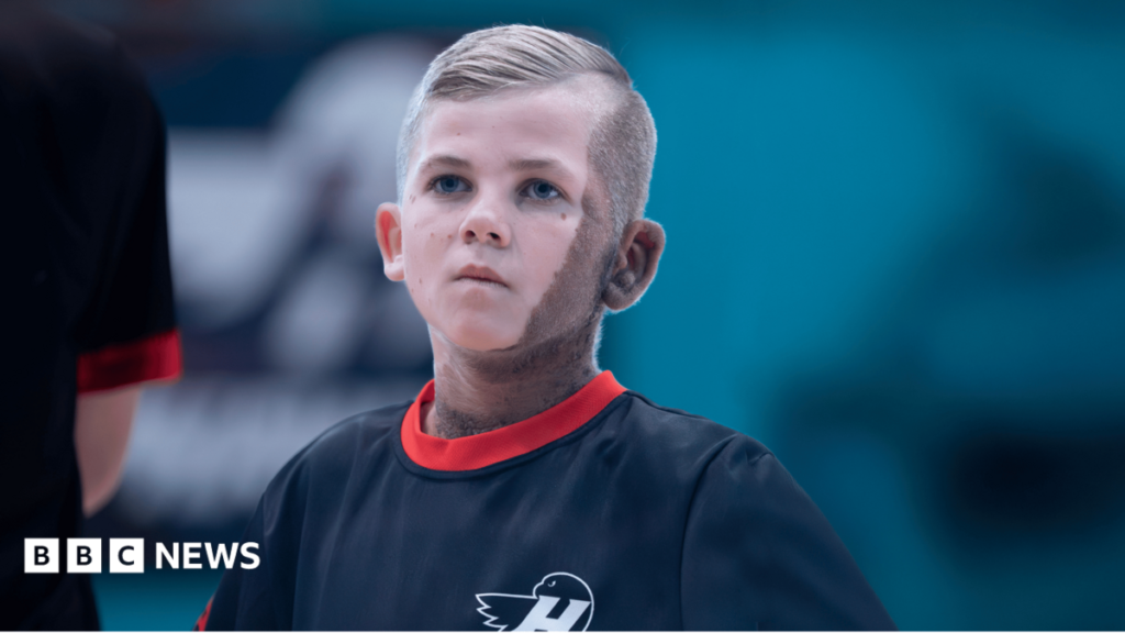 CMN birthmark no barrier for young footballing TV star