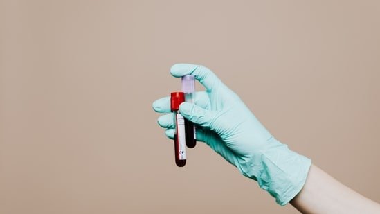 Heart surgeon with 25 years of experience shares 4 blood tests men should track with age: ‘Predictor of heart attack…’