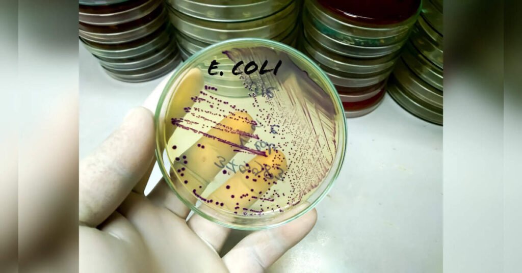 E. coli Outbreak Caused by Illegally Sold Drinking Water in Karnataka’s Chikkaballapur Village, ETHealthworld