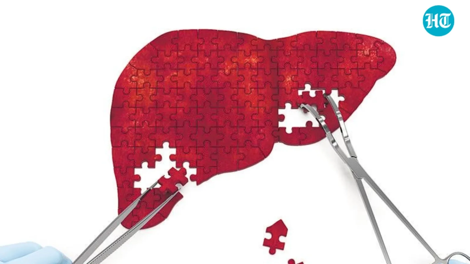 Blood tests as crucial to hepatitis elimination