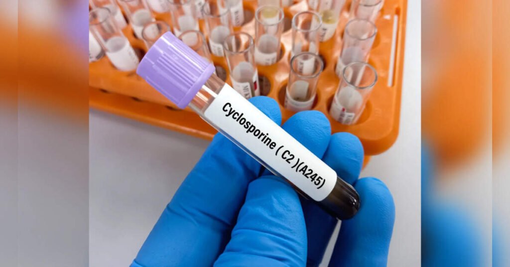 Michigan Records Largest Cyclospora Outbreak with Nearly 1,000 Cases, ETHealthworld