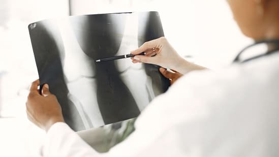 What are the early symptoms of bone cancer? Ortho oncologist Dr Nikhil Tandon explains