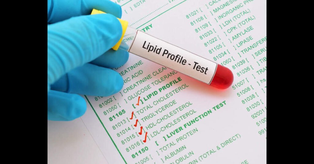 Nine in ten Indian adults have abnormal blood lipids, ETHealthworld