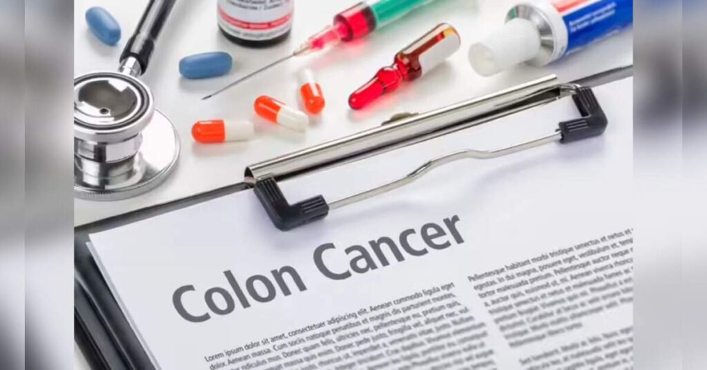 New Study Reveals Mechanism Behind Deadly Spread of Colorectal Cancer, ETHealthworld