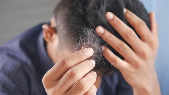 Can hair loss be predicted before it starts? Plastic surgeon Dr Debraj Shome reveals