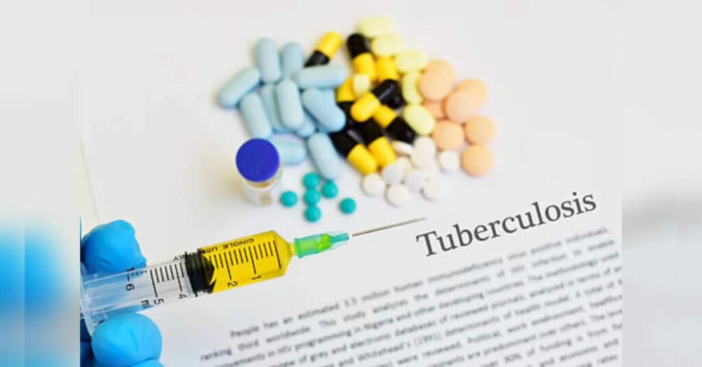 UP detects 1.85 lakh new TB cases in 100-day drive, ETHealthworld