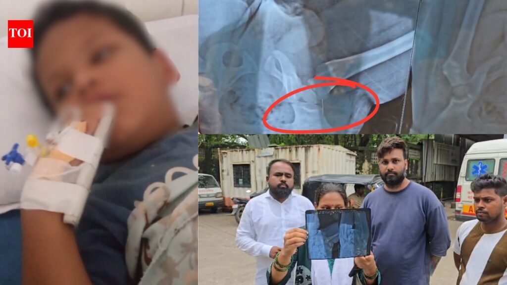 Toddler undergoes surgery after broken syringe needle left inside body at Maharashtra hospital | Thane News