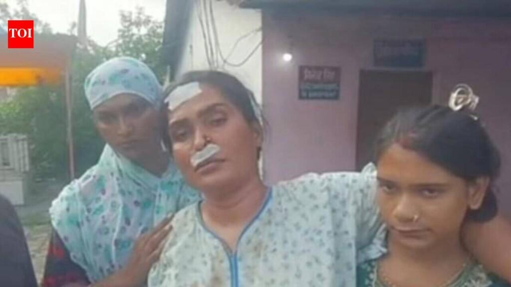 Eunuch robbed of ₹10 lakh, gold at gunpoint; probe on | Kanpur News