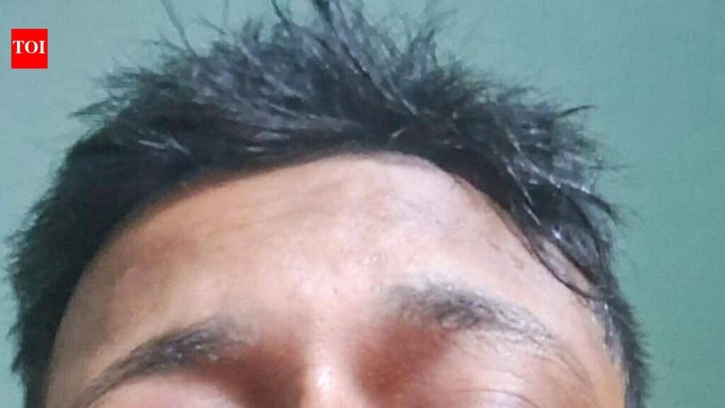 Kol Theatre Activist Bashed Up After Row Over Religion | Kolkata News