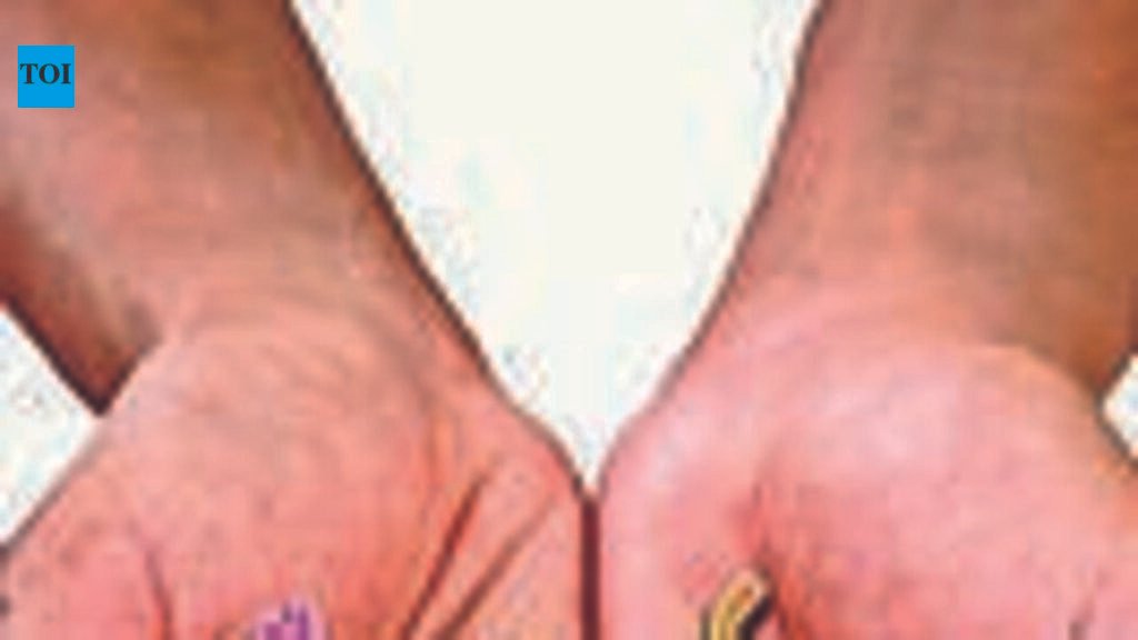 Shortage of organ, eye, body donors in Sangam city