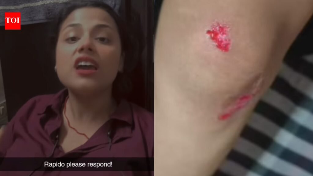 Delhi woman jumps off Rapido scooter after driver takes her to deserted place, gets injured