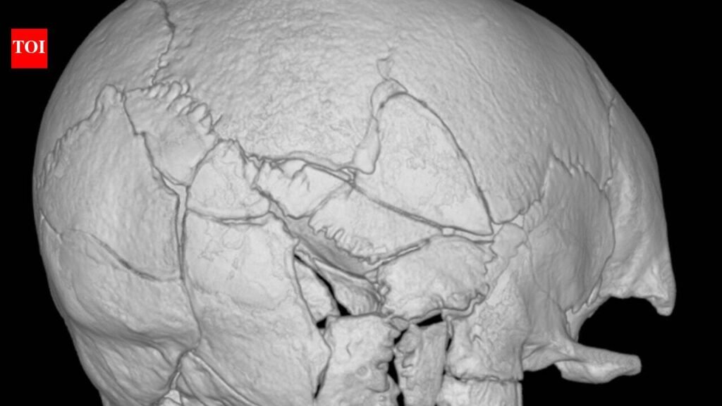 A skeleton found beneath Scotland’s Stirling Castle had more than 160 fractures; researchers say it is the first confirmed death from a trebuchet