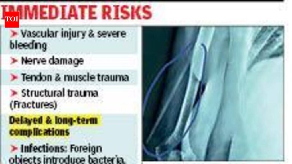 Docs extract 6-inch plastic strip from 59-year-old woman’s arm | Kolkata News