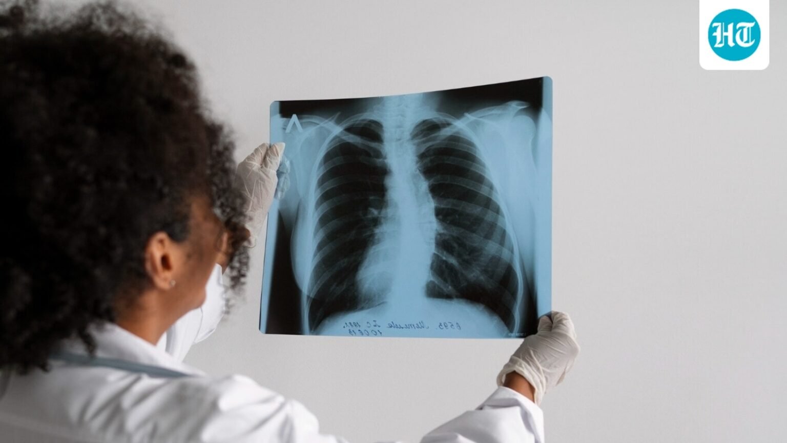 Can non-smokers get lung cancer? Pulmonologist Dr Manish Kumar Aggarwal shares 5 preventive habits