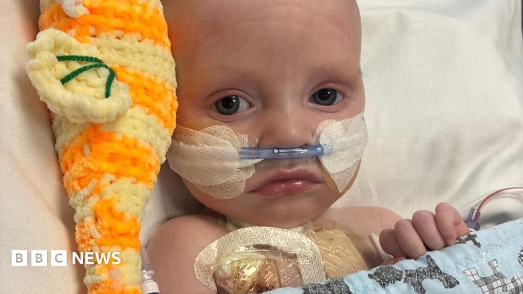 Cardiff baby gets life-saving heart op – but needs a transplant