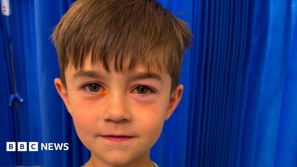 Fake squishy toy explodes in Bridgend boy’s face