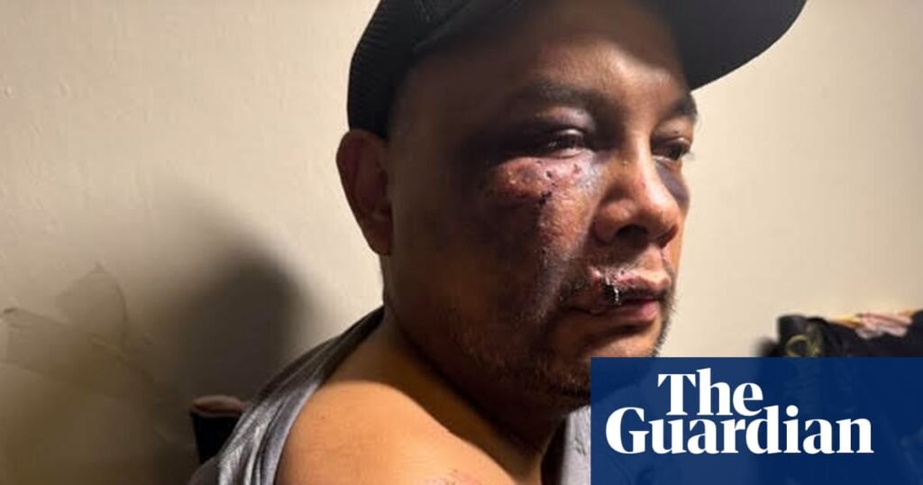 Man suffered brain injury and severe bruising after ICE arrest in Virginia, records show | ICE (US Immigration and Customs Enforcement)