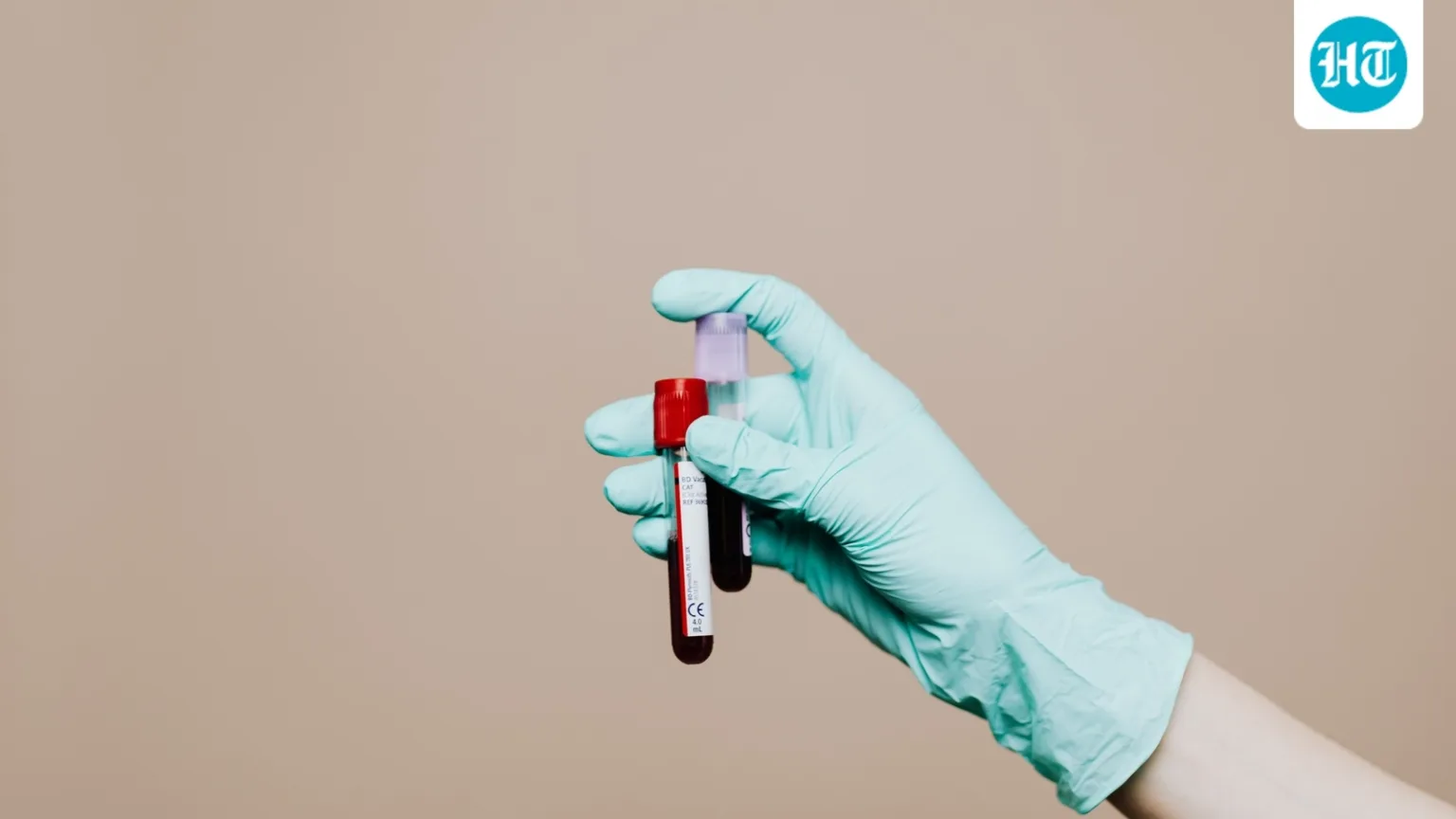 Men over 40, don’t skip these health tests: Doctor shares 5 risks to screen for, from blood sugar to fatty liver