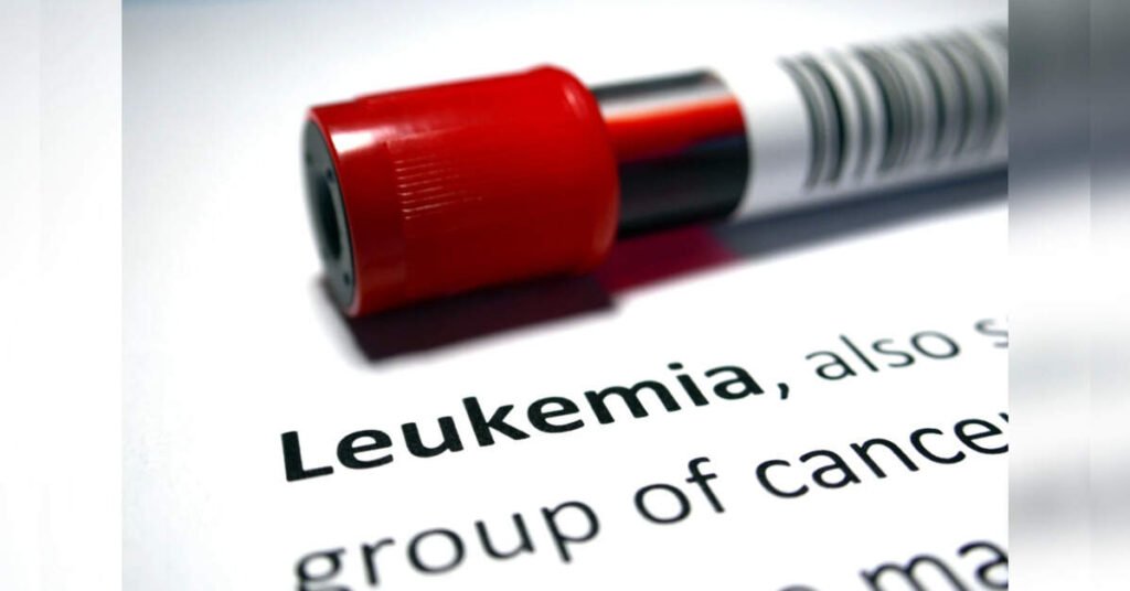 India accounts for 70% of South Asia’s childhood leukaemia cases: Study, ETHealthworld