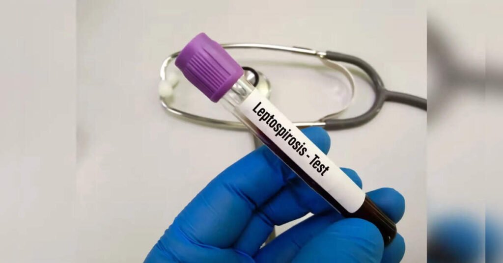 Leptospirosis cases surge nearly 125-fold in Telangana in two years, ETHealthworld