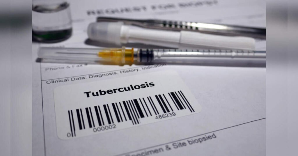 Bihar Detects Over 87,600 Tuberculosis Cases in Statewide Screening Drive, ETHealthworld